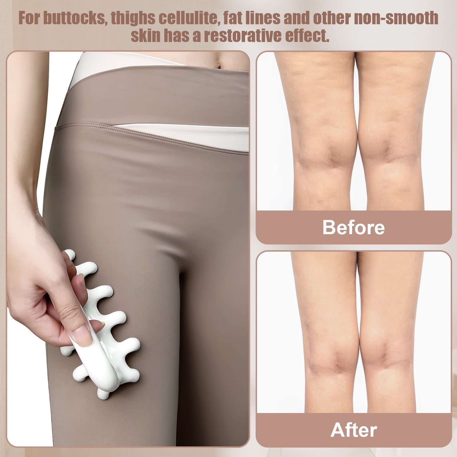 Anti Blaster for Cellulite s Release Muscle Knot Reduction Cellulite White - Image 3