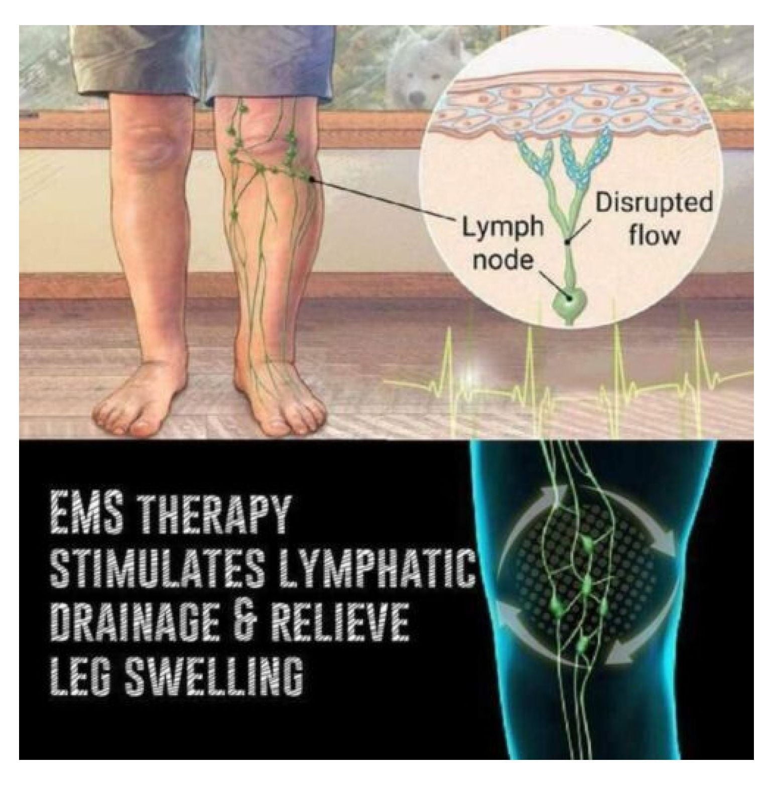 Leg Reshaping Electric Deep Kneading Muscle Pain Machine - Image 3
