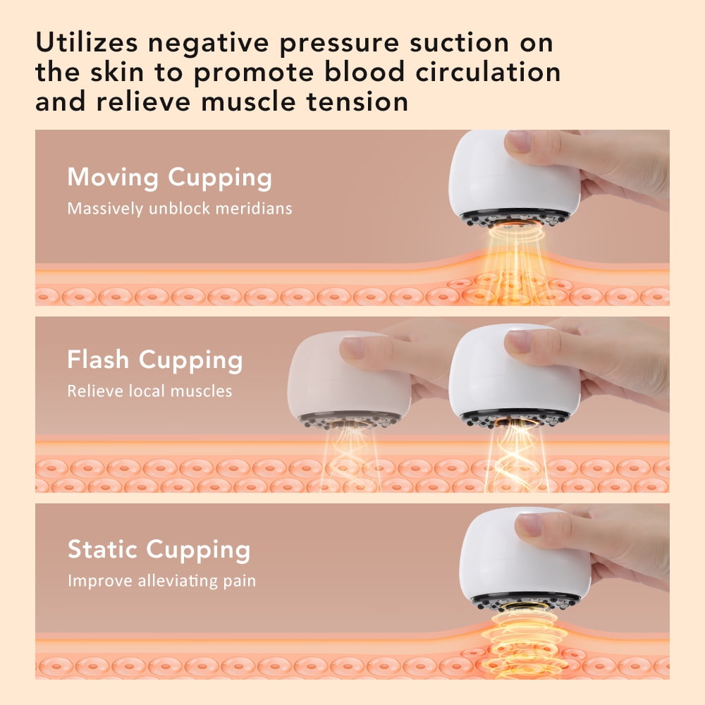 4-in-1 Cupping Set 9-Level Electric Cupping Kit for Back, Neck, Legs & Muscle Relaxation Portable Rechargeable Massag... - Image 5