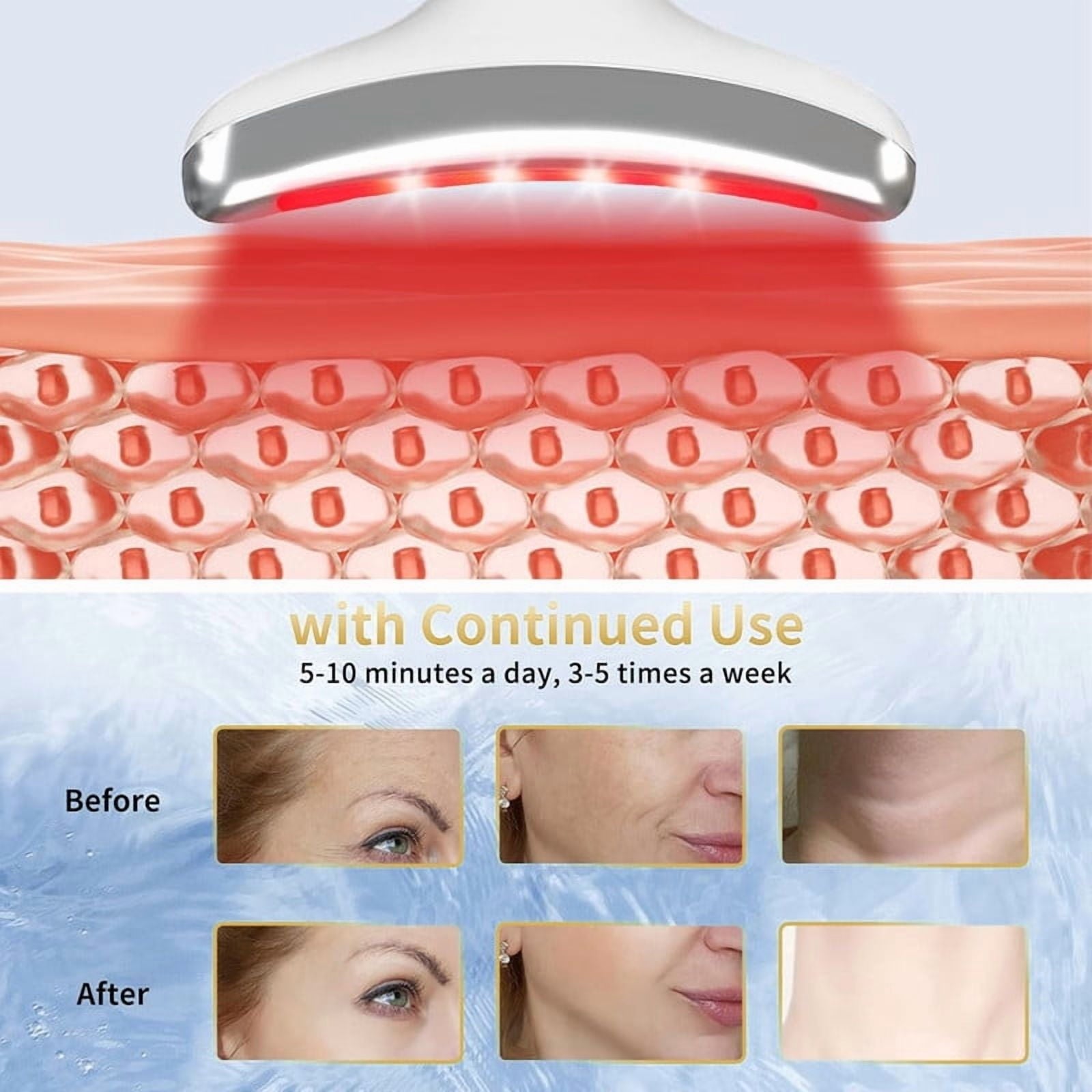 Device, Skin Care Massager, LED Light Therapy Face Sculpting Tool, Multifunctional Rollers for Women - Image 2